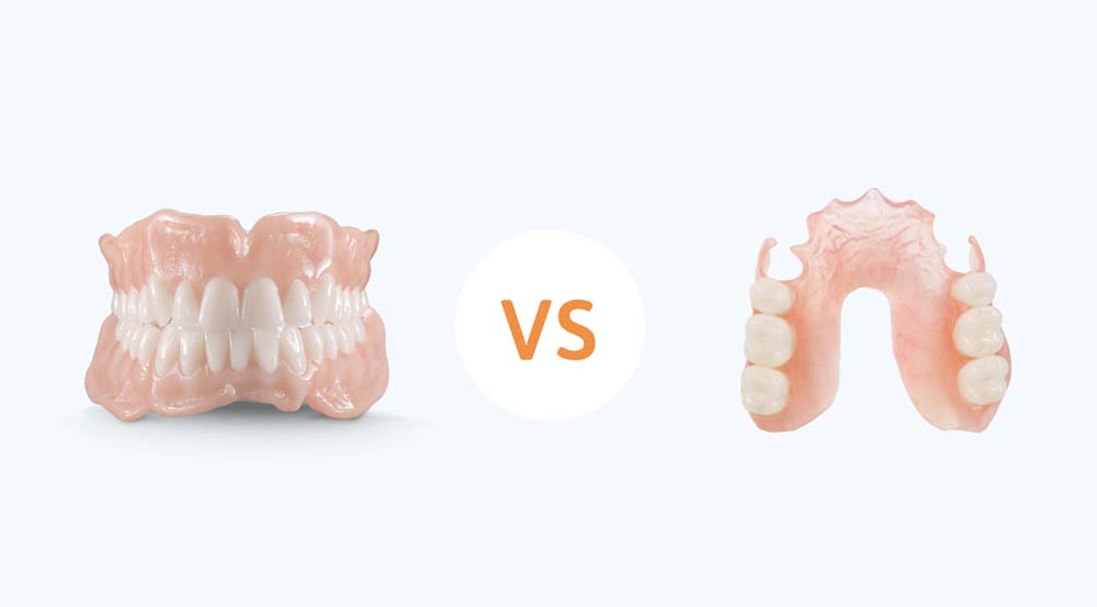 full dentues vs partial dentures